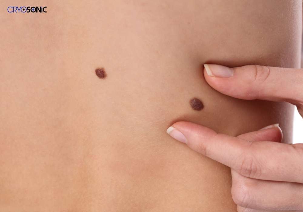 Infection Risk and Poor Aftercare Chichester