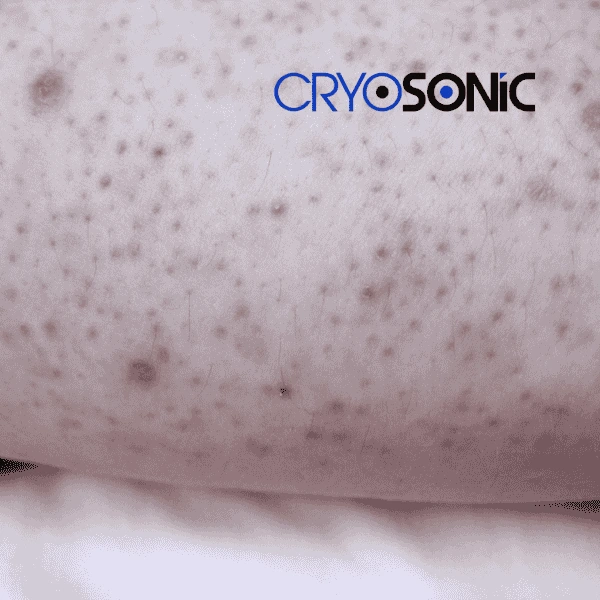 What Would Your Skin Look Like in 10 Years If You Started Daily Photoprotection Today Chichester