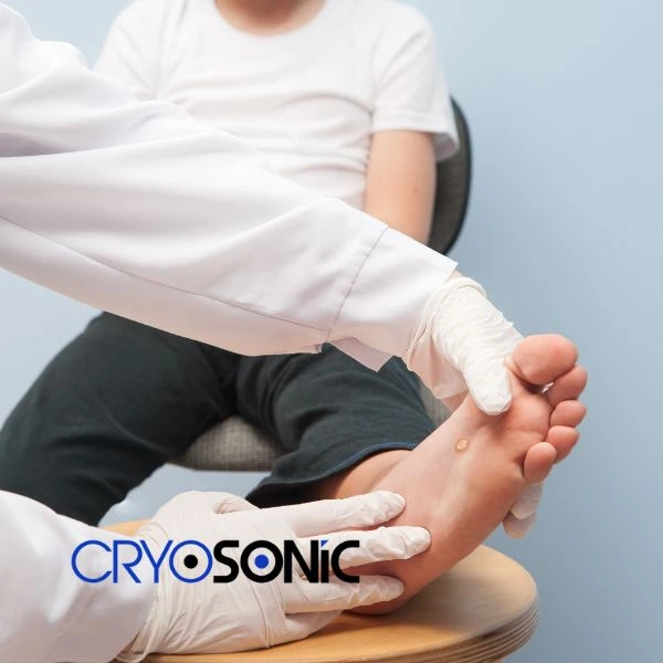 Are you looking for fast effective wart removal Contact us today Chichester